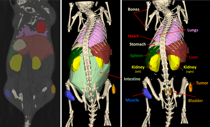 OrganSegmentation.png